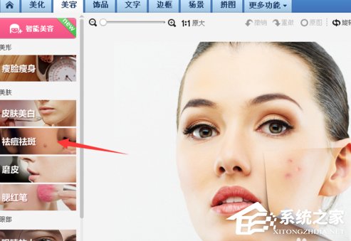 美圖秀秀怎么去除痘痘？美圖秀秀去除痘痘的方法