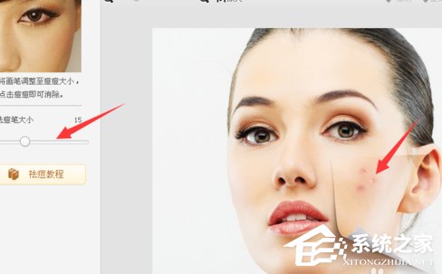 美圖秀秀怎么去除痘痘？美圖秀秀去除痘痘的方法